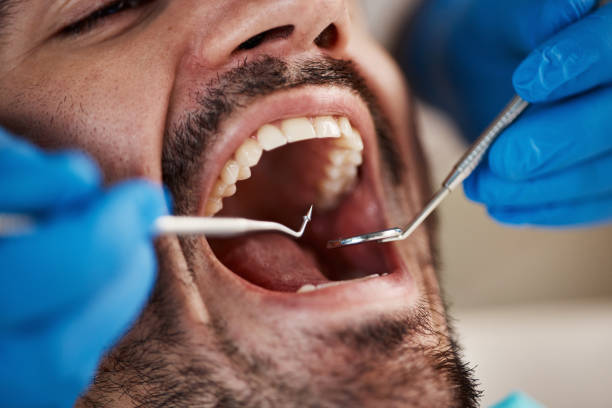 Best Knocked-Out Tooth Emergency  in Three Lakes, WA